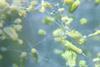 Microscope_view_of_Aspergillus_flavus_growing_on_a_leather_sample_27