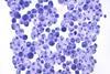 Asco_Candida_albicans
