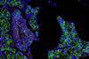 Salivary_Gland_Cells_infected_with_SARS-CoV-2_(51105883890)