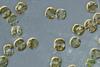 Low-Res_FKt240412-20240424-PeterVonDassowMicroscopeImagery-diatoms_that_sunk_to_50m