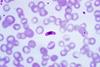 Macrogametocyte_of_the_parasite_Plasmodium_falciparum_PHIL_2701_lores