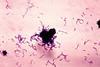 Streptococcus_mutans_01