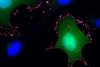 Low-Res_ANDV(green)_PCDH1(pink) 1 1