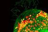 Paramecium bursaria with Chlorella spp. (red) and nucleic acid (bright greenyellow), highlighting the nucleic acid in symbiont nuclei and ribosomes