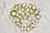 Microcystis_aeruginosa