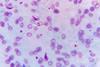 Plasmodium_falciparum_gametocyte