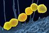Streptococcus_Pyogenes_(Group_A_Strep)_(52602981880)