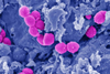 Low-Res_Streptococcus pyogenes