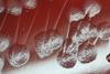 Pseudomonas_aeruginosa_colony_morphology_on_blood_agar