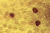 Chlamydia_trachomatis.tif