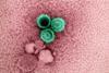 Epstein-Barr_Virus_(EBV)_Particles_-_53582693012