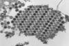 Chikungunya_virus_particles-PHIL-17369 (1)
