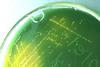 Vibrio_cholerae_on_TCBS_agar