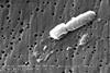 Klebsiella-pneumoniae