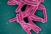 Mycobacterium_Tuberculosis_Bacteria,_the_Cause_of_TB_(52766234986)