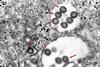 544px-Rift_Valley_Fieber_Virus