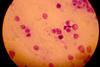 Leishmania_(02)