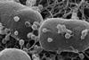 Escherichia_coli_with_phages