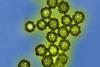 H1N1_Influenza_Virus_Particles_(8411599236)