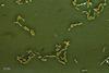 Escherichia_coli_(257_06)_Gramnegative_rods