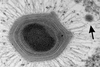Giant_Mimivirus_with_satellite_Sputnik_virophages