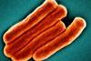 Mycobacterium_Tuberculosis_Bacteria,_the_Cause_of_TB_(52766648105)