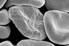 Red_blood_cells_infected_with_malaria