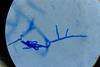 Low-Res_CWB_structure_under_the_microscope
