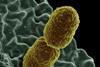 Klebsiella_pneumoniae_Bacterium_(13383411493)