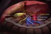 3D medical illustration showing hepatic hilum,hepatic artery, portal vein.
