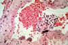 CSIRO_ScienceImage_321_Cross_Section_of_Blood_Vessel_With_Hendra_Virus