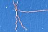 Lyme_disease_parasite_Borrelia_burgdorferi