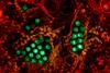 Dengue_Virus_Particles_(53231045112)