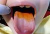 Low-Res_bad breath