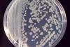 Enterobacter_cloacae_01