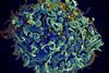 HIV_infecting_a_human_cell_(20683459455)
