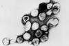 Rubella_virus_TEM_B82-0203_lores