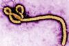 Low-Res_Ebola_virus_purple_CDC Kopie (1)
