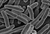 E._coli_Bacteria_(7316101966)