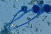 Conidia,_sterigma,_vesicle,_and_conidiophore_of_Aspergillus