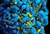 HIV-infected_T_cell_(6813384933)