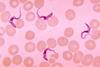 Trypanosoma forms in blood smear