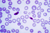 Plasmodium_falciparum_01