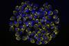 Low-Res_20250308_UExM_tgDS083_72h_IAA_SetB_Tub-Cen_002 - Deconvolved, Type Automatic-MaxIP_GOOD