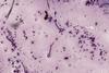 Onchocerca_volvulus_(YPM_IZ_093383)