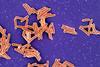 Mycobacterium tuberculosis_Bacteria