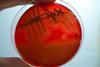 Staphylococcus_aureus-blood_agar-_hemolysis_detail