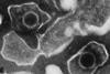 Epstein_Barr_Virus_virions_EM_10.1371_journal.pbio.0030430.g001-L