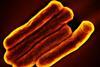 Mycobacterium_Tuberculosis_Bacteria,_the_Cause_of_TB_(52766234426)
