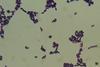 Enterococcus_faecium_in_Gram_Staining_of_culture